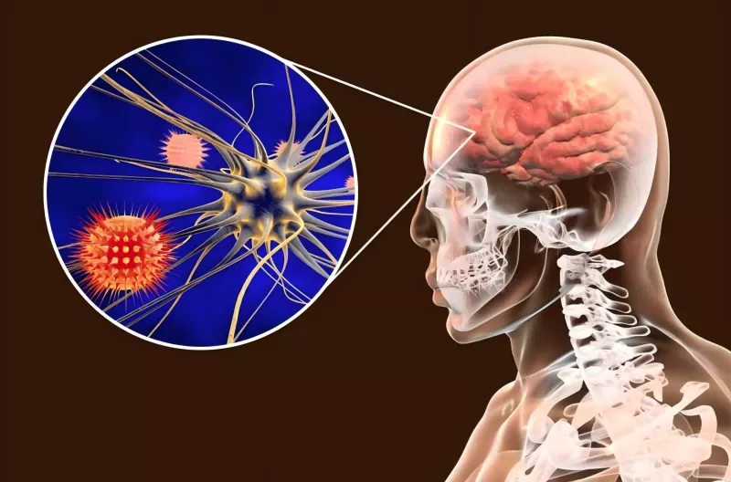 Guida ai vaccini contro il meningococco